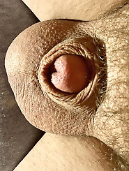 Tiny penis, micro, cock, inverted cock photos